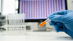 Anthropic 的 Claude 在首個濕實驗室發現中辨識出類 CRISPR 酶系統